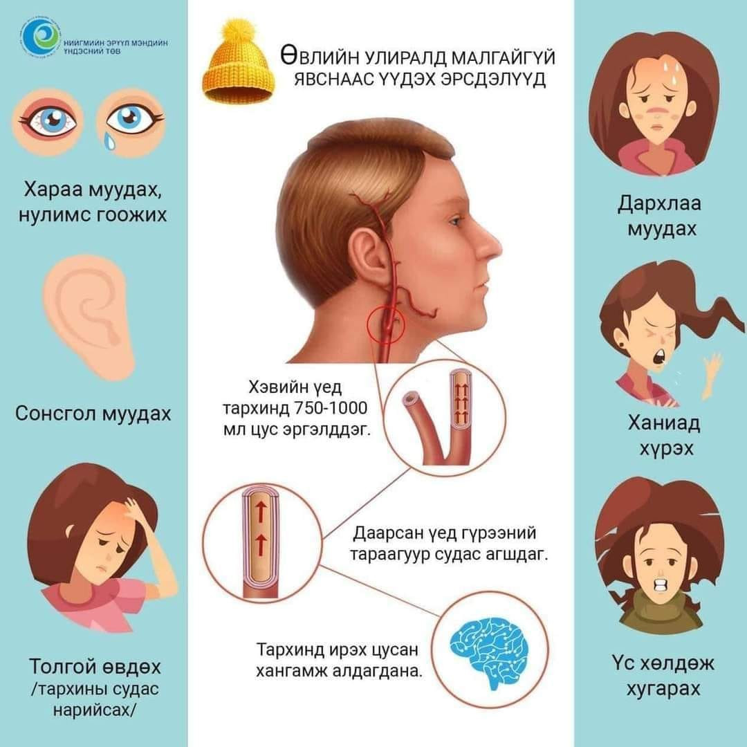 ХҮЙТЭН СЭРҮҮНИЙ УЛИРАЛД ГАДАА ГАРАХДАА ТОГТМОЛ МАЛГАЙ ӨМСӨЖ ХЭВШЭЭРЭЙ.