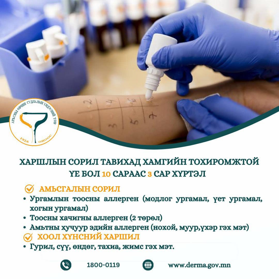 🔸Харшлын сорил тавихад хамгийн тохиромжтой үе бол 10 сараас 3 сар хүртэл…