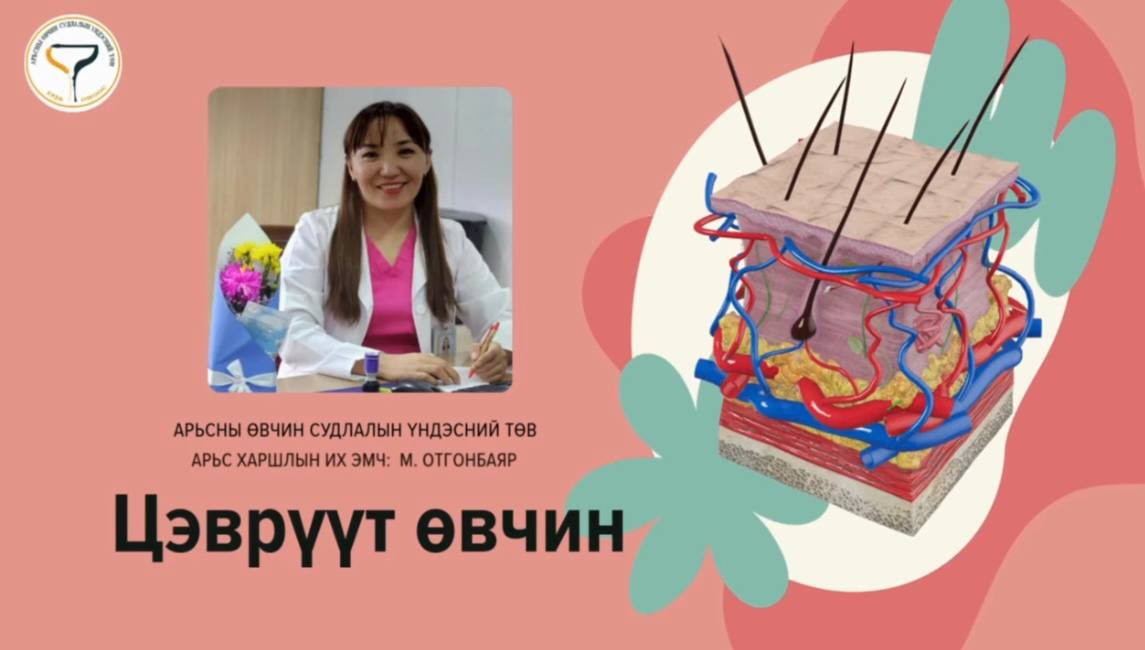 👩‍⚕️АӨСҮТ-ийн поликлиникийн тасгийн арьс, харшлын их эмч М.Отгонбаяр "Цэврүүтэх өвчин” сэдвээр мэдээлэл хүргэж байна✅